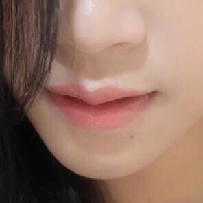 ทำปากกระจับ รังสิต - คลินิกศัลยกรรมตกแต่งเสริมสวย รังสิต