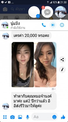 ทำตาสองชั้น หมอจำนงค์ - คลินิกศัลยกรรมตกแต่งเสริมสวย รังสิต