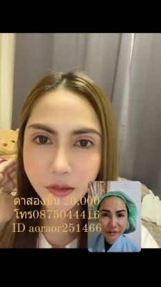 ทำตาสองชั้นราคาถูกโดยหมอศัลกรรม - คลินิกศัลยกรรมตกแต่งเสริมสวย รังสิต