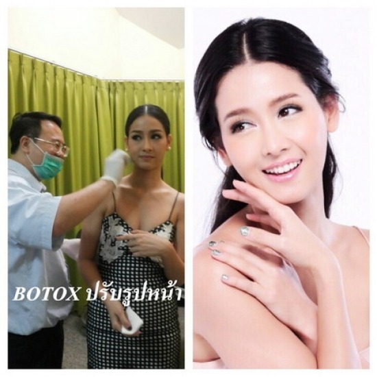 ฉีด Botox ปรับหน้าเรียว ฉีด Botox ปรับหน้าเรียว
