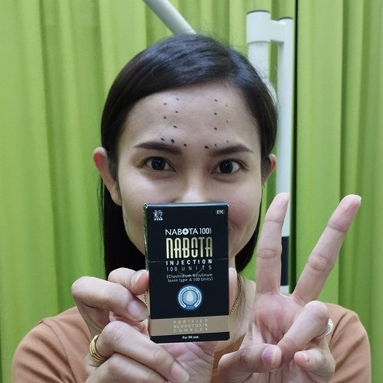 คลินิกศัลยกรรมตกแต่งเสริมสวย รังสิต - ฉีดโบทอกซ์ราคาพิเศษโดยแพทย์ศัลยกรรม