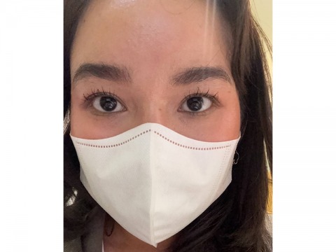 ปรับแก้ไขหนังตาให้เข้ารูป